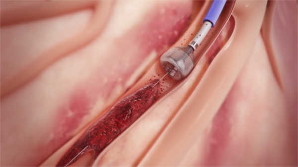 外國醫學視頻動畫3d英文字幕