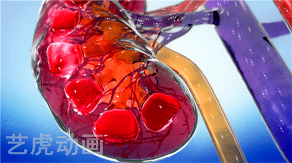 3d醫學動畫冠狀動脈血管造影術