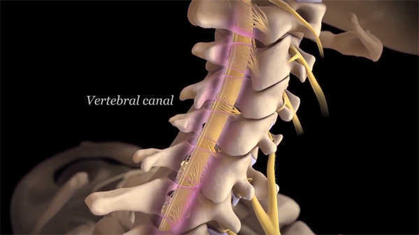 醫學三級動畫肱二頭肌修復術