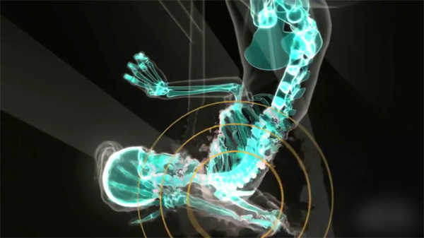 口腔醫(yī)學(xué)動畫設(shè)計