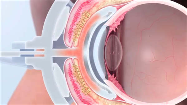你的肺是什么樣子3d醫學動畫