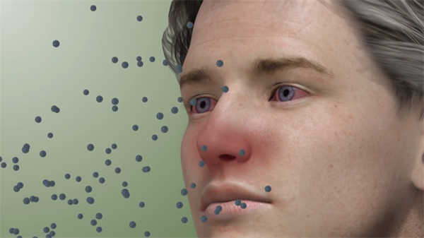 醫(yī)學(xué)3d動(dòng)畫演示鼻竇炎做手術(shù)