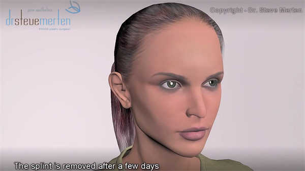 女性醫學3d動畫演示插導尿管