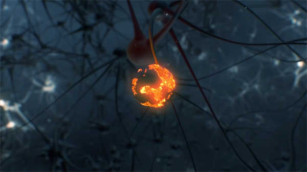 3d醫(yī)學(xué)動畫冠脈球囊擴張術(shù)