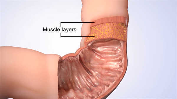 肛腸科醫(yī)學(xué)科普3d動畫演示