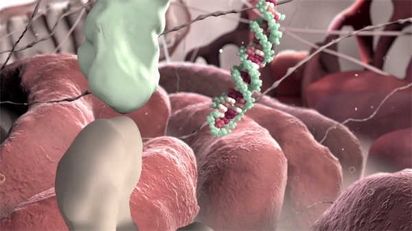 醫(yī)學(xué)3d動畫膝關(guān)節(jié)置換術(shù)