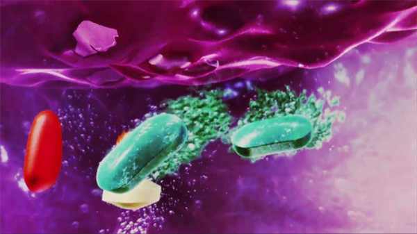 醫(yī)學(xué)3d動畫演示腦內(nèi)動脈瘤