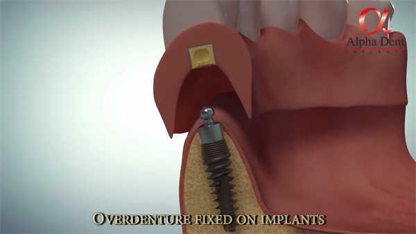 止血醫(yī)學(xué)動(dòng)畫