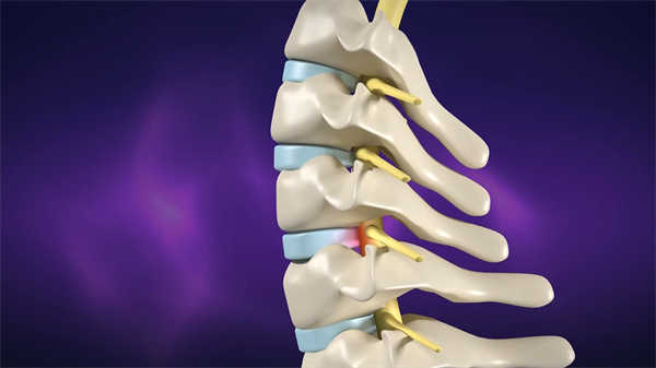 醫(yī)學(xué)骨科動(dòng)畫(huà)