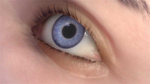 醫(yī)學(xué)ae動(dòng)畫(huà)