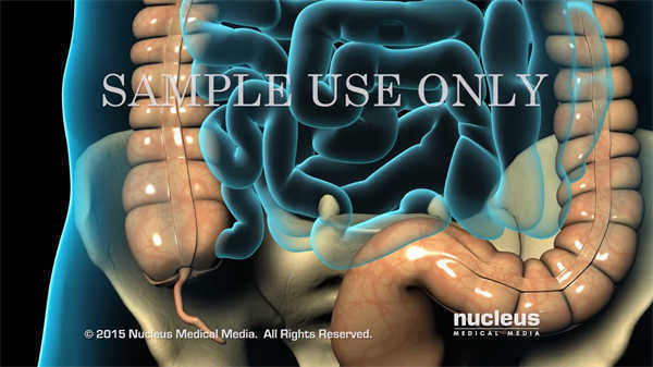 醫(yī)學(xué)常識科普動畫