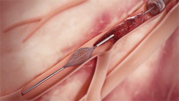 醫(yī)學(xué)設(shè)備動畫產(chǎn)品介紹