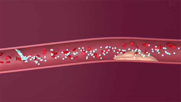 兒童3d醫學動畫心臟