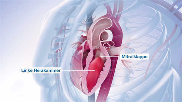 醫(yī)學(xué)動(dòng)畫模擬心臟手術(shù)