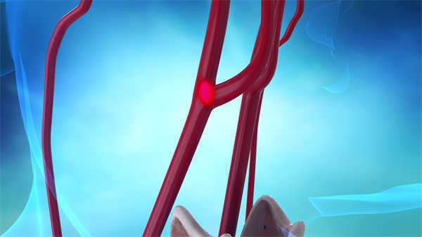 血管醫(yī)學(xué)產(chǎn)品動畫