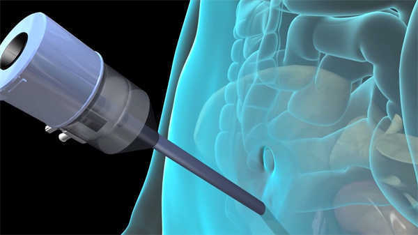 醫(yī)學(xué)3d動畫產(chǎn)品